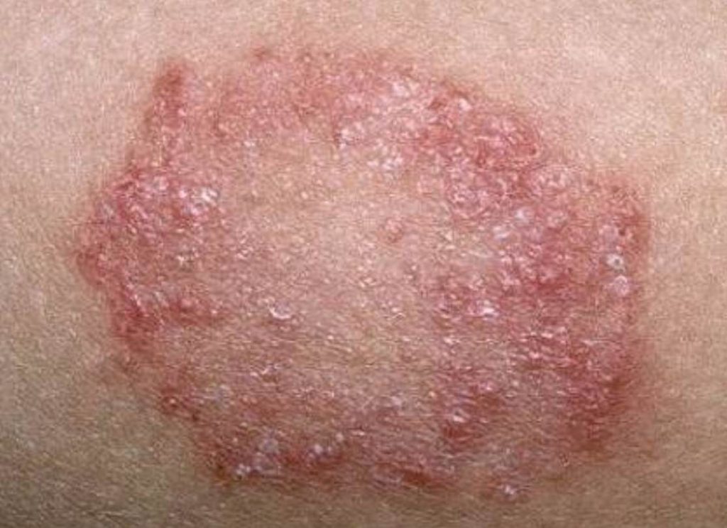 different skin rashes that itch