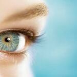 Strabismus